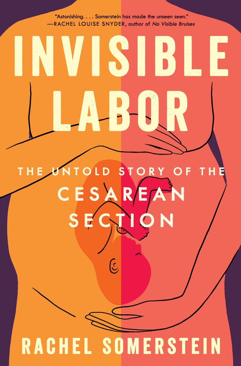 Invisible Labor: The Untold Story of the Cesarean Section