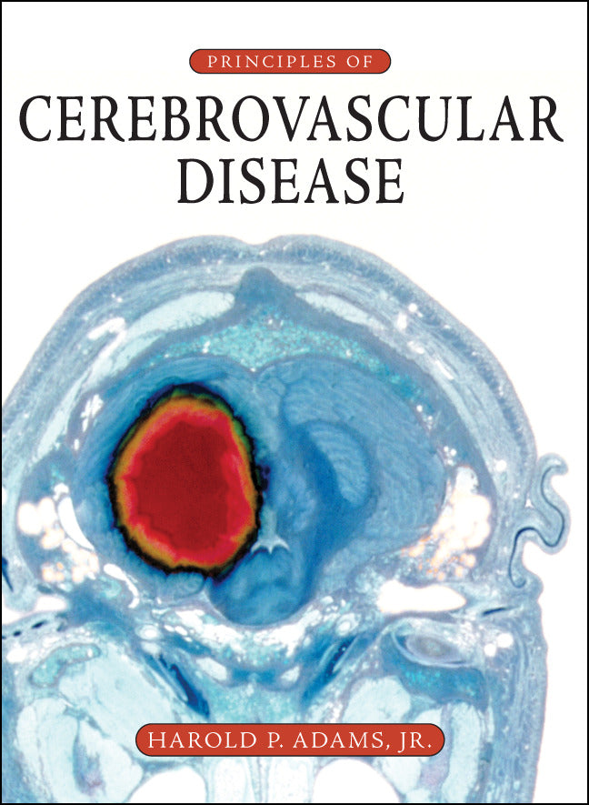 Principles Of Cerebrovascular Disease