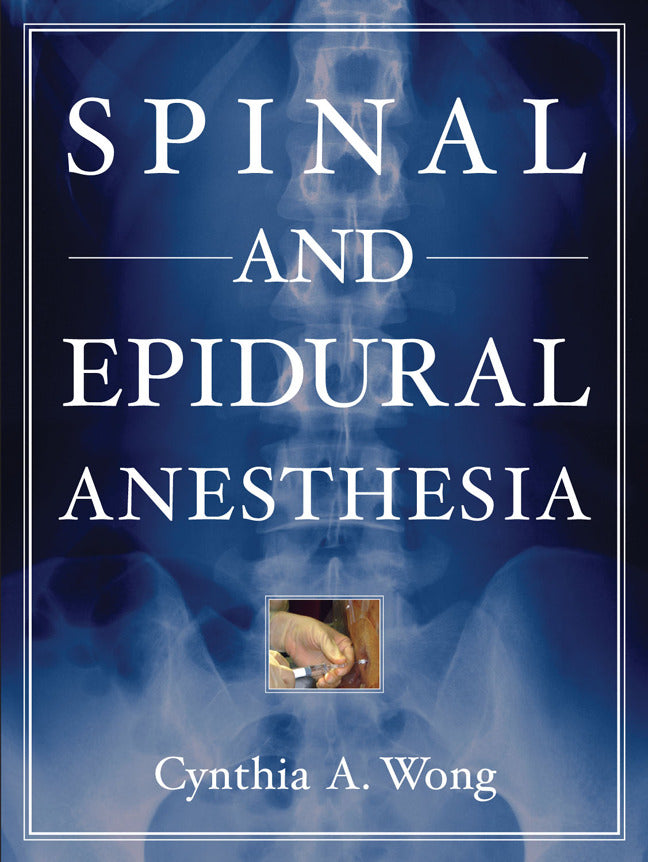 Spinal & Epidural Anesthesia