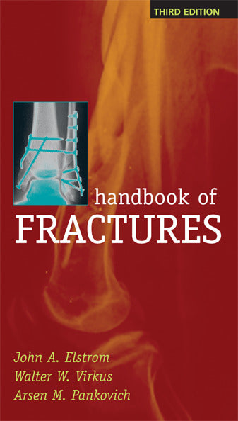 Handbook Of Fractures Third Edition 3e