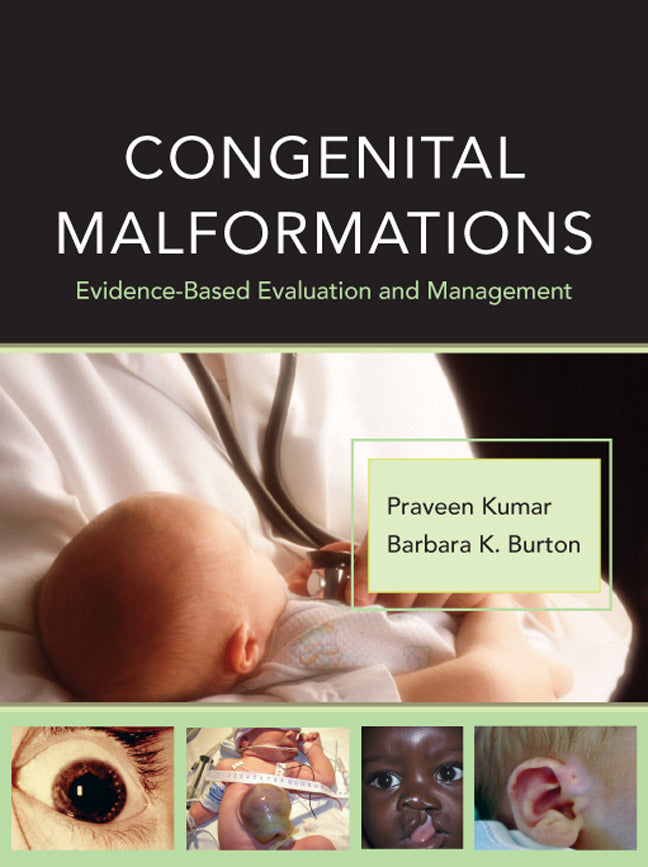 Congenital Malformations Evidence Based Evaluation & Management
