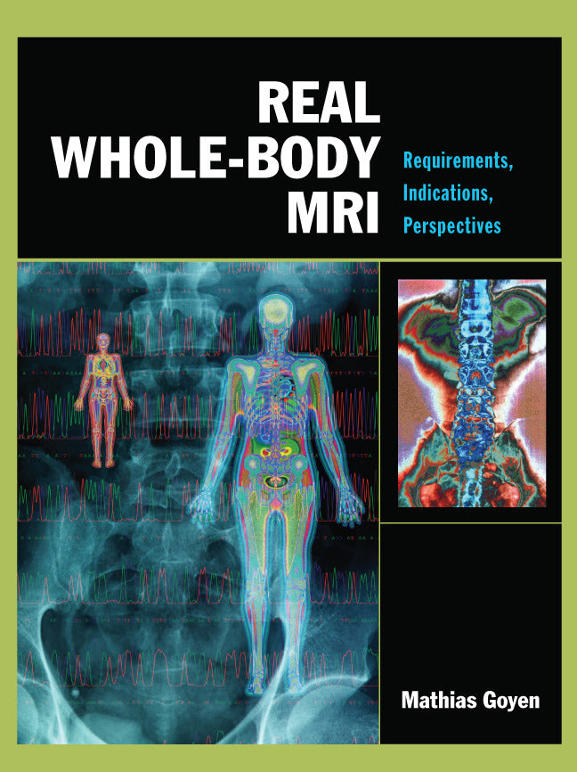 Real Whole Body Mri Requirements Indications Perspectives
