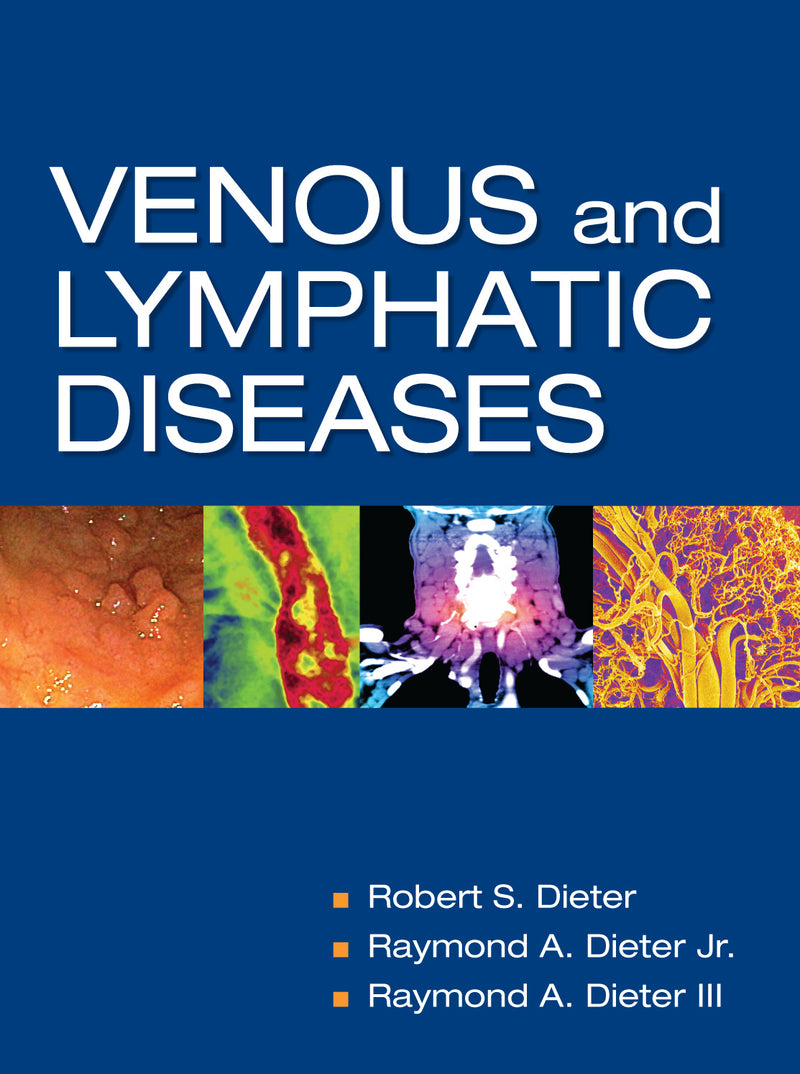 Venous & Lymphatic Diseases