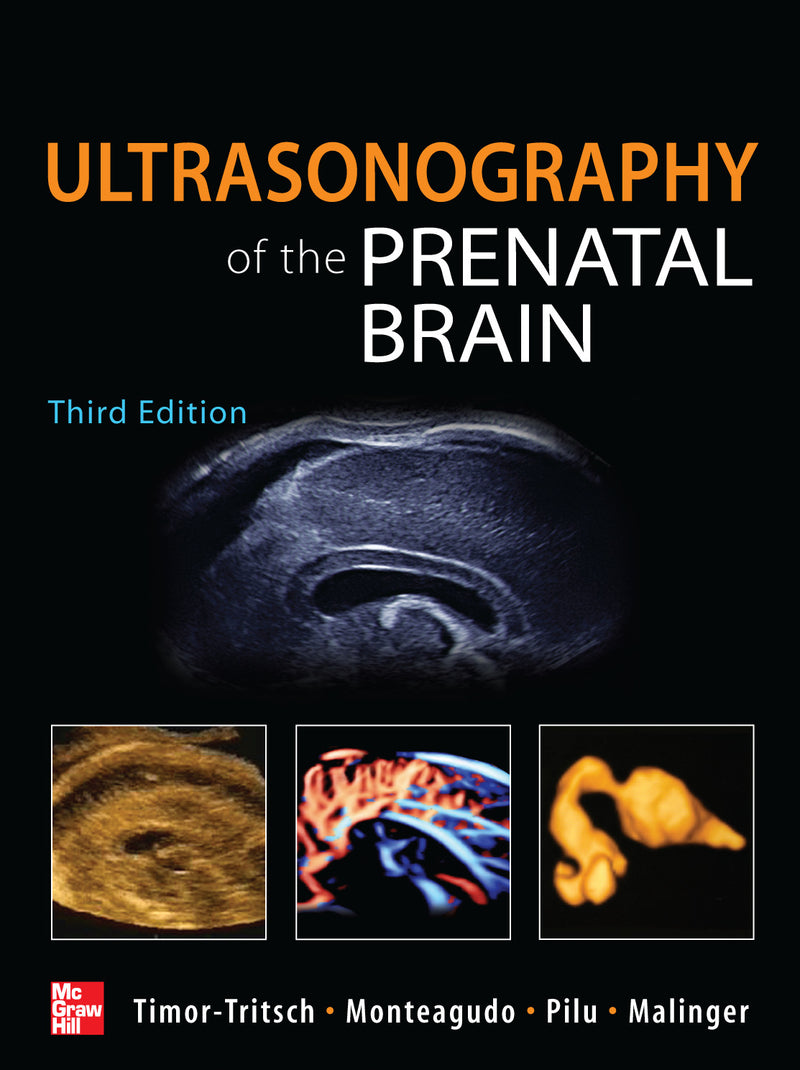 Ultrasonography Of The Prenatal Brain Third Edition 3e