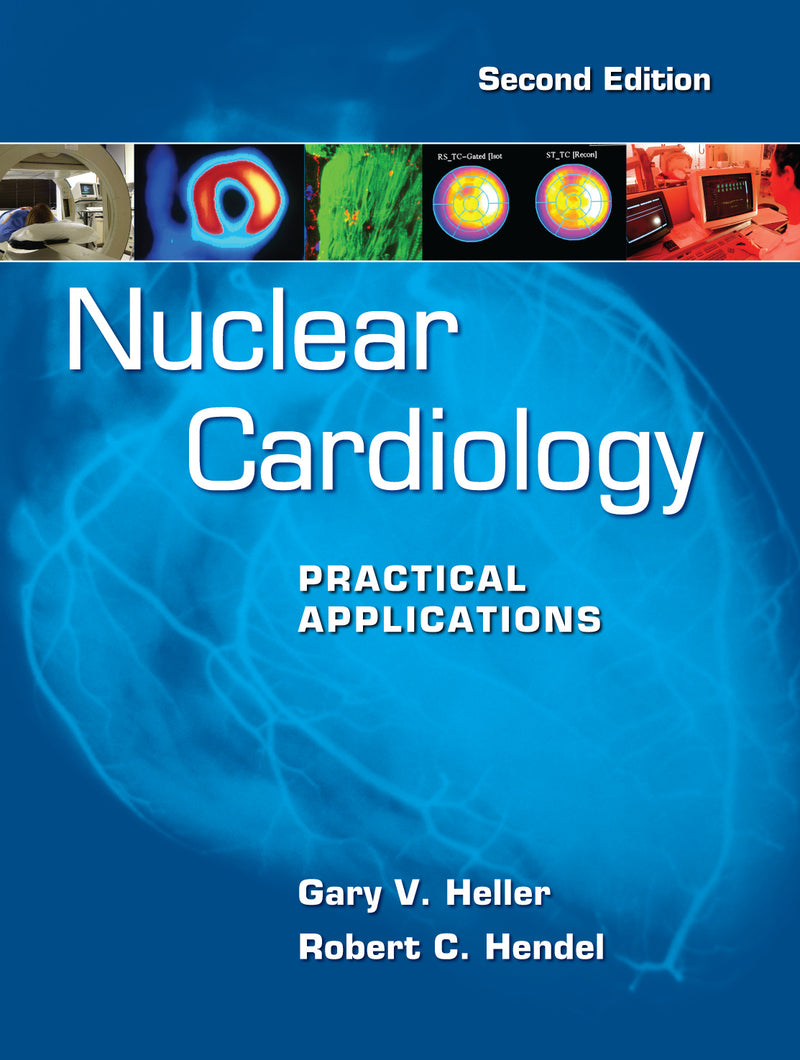 Nuclear Cardiology Practical Applications Second Edition 2e
