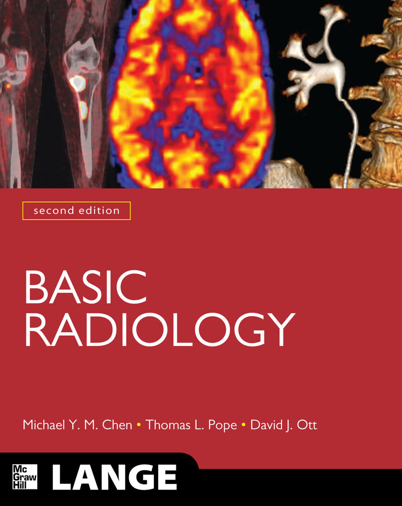 Basic Radiology Second Edition 2e