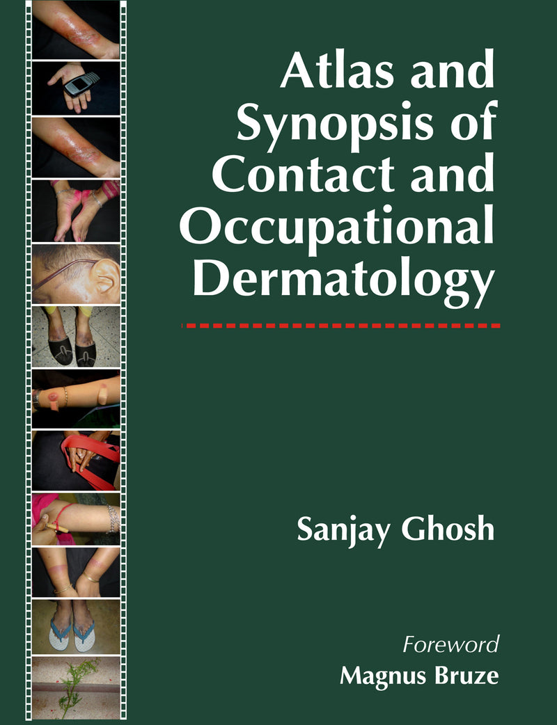 Atlas & Synopsis Of Contact & Occupational Dermatology