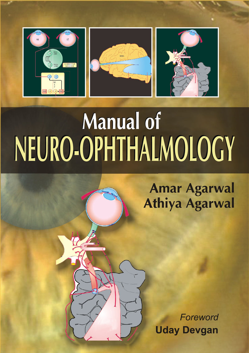 Manual Of Neuro Ophthalmology