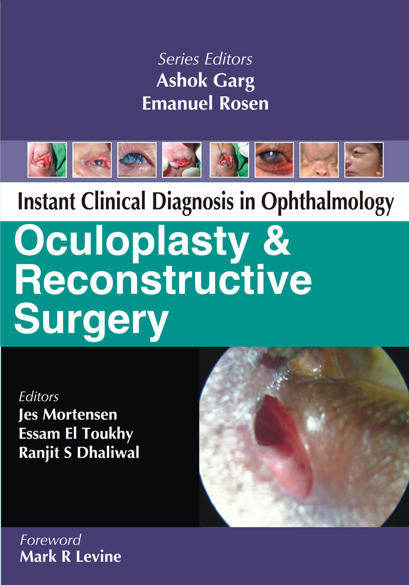 Oculoplasty & Reconstructive Surgery