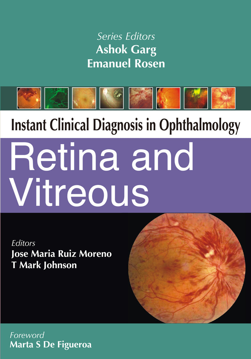 Retina & Vitreous