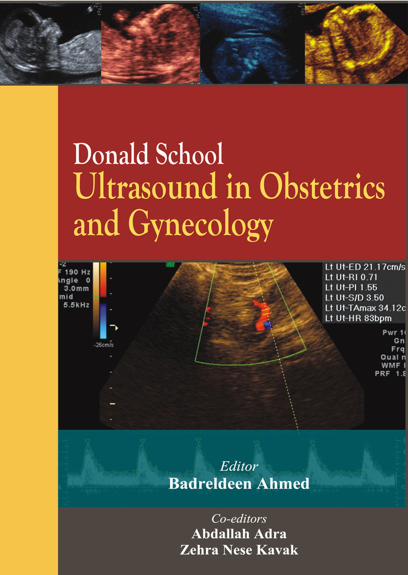 Donald School Ultrasound In Obstetrics & Gynecology
