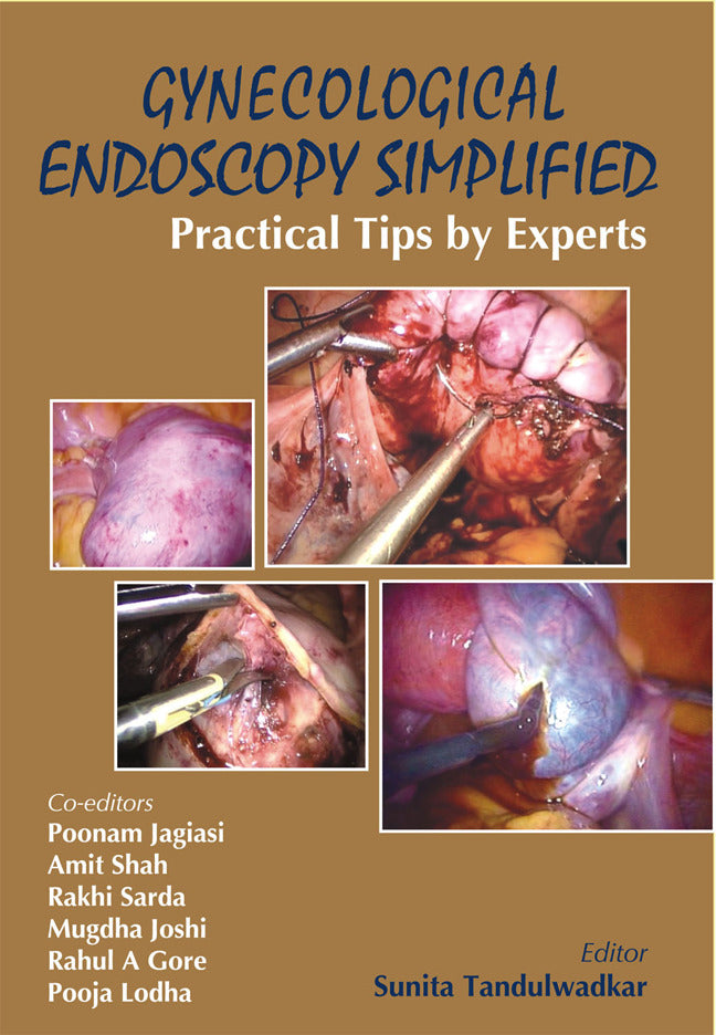 Gynecological Endoscopy Simplified Practical Tips By Experts