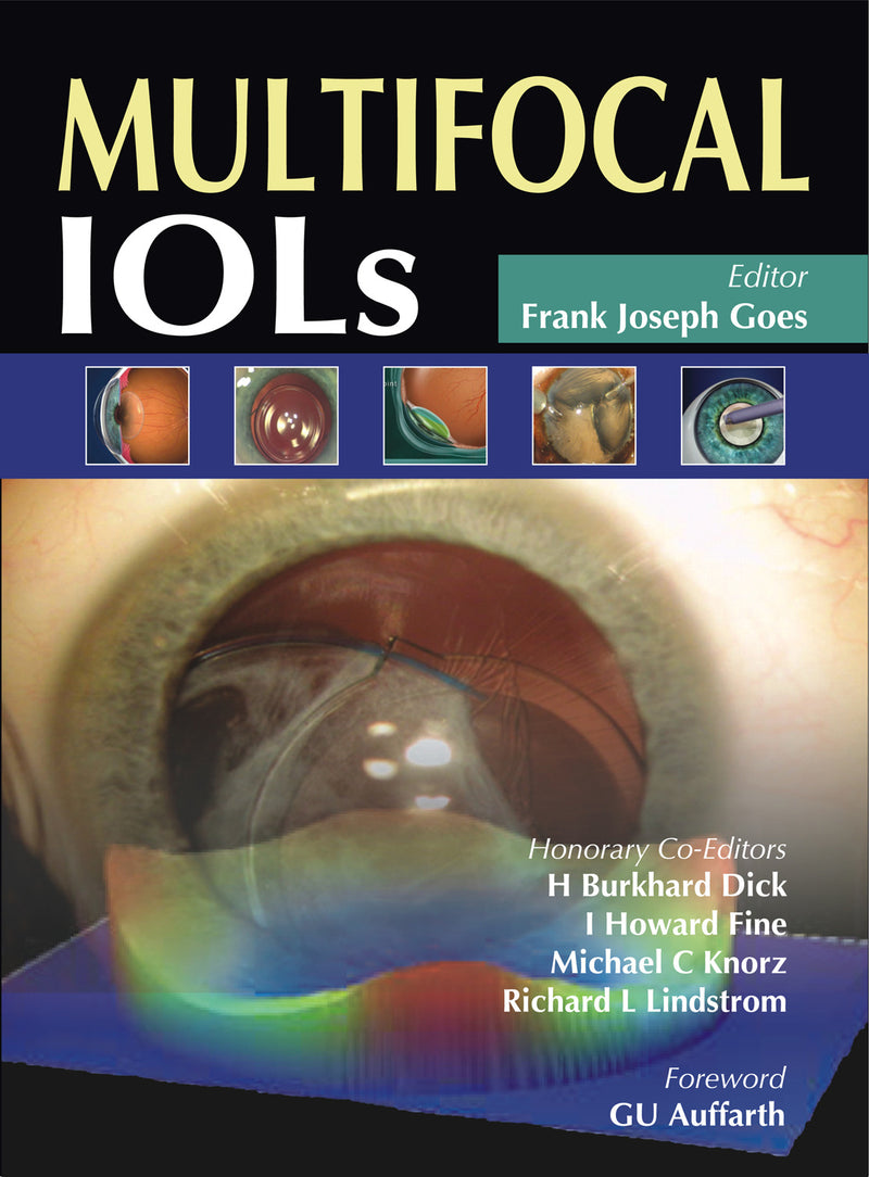 Multifocal Iols