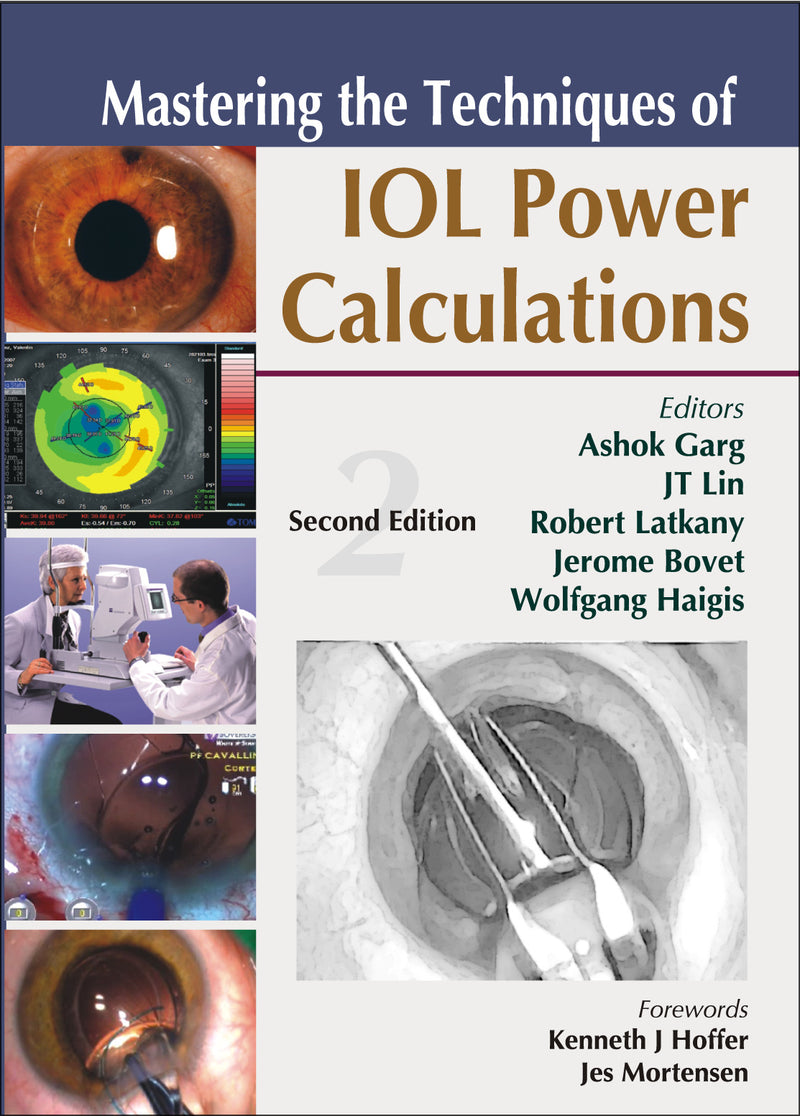 Mastering The Techniques Of Iol Power Calculations Second Edition 2e