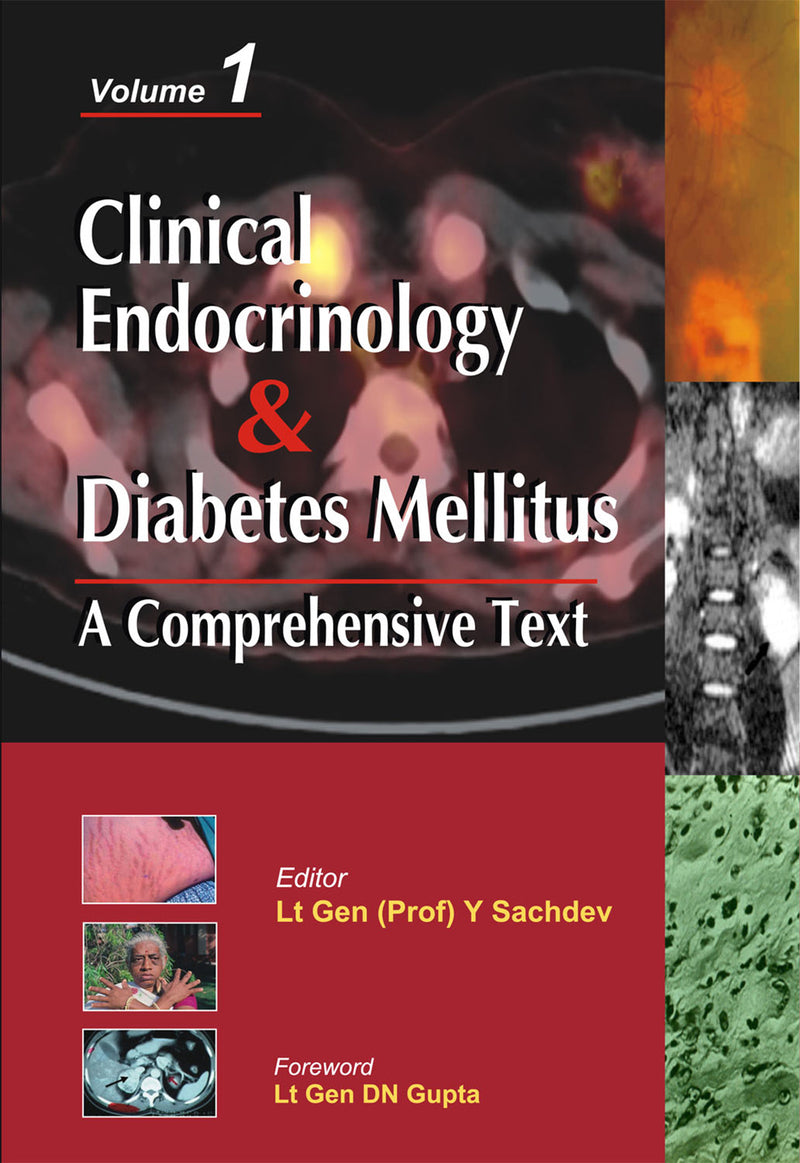 Clinical Endocrinology & Diabetes Mellitus Two Volume Set