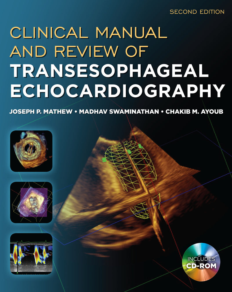 Clinical Manual & Review Of Transesophageal Echocardiography Second Edition 2e