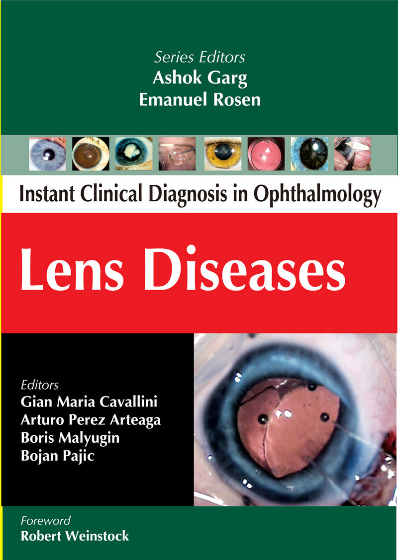 Lens Diseases