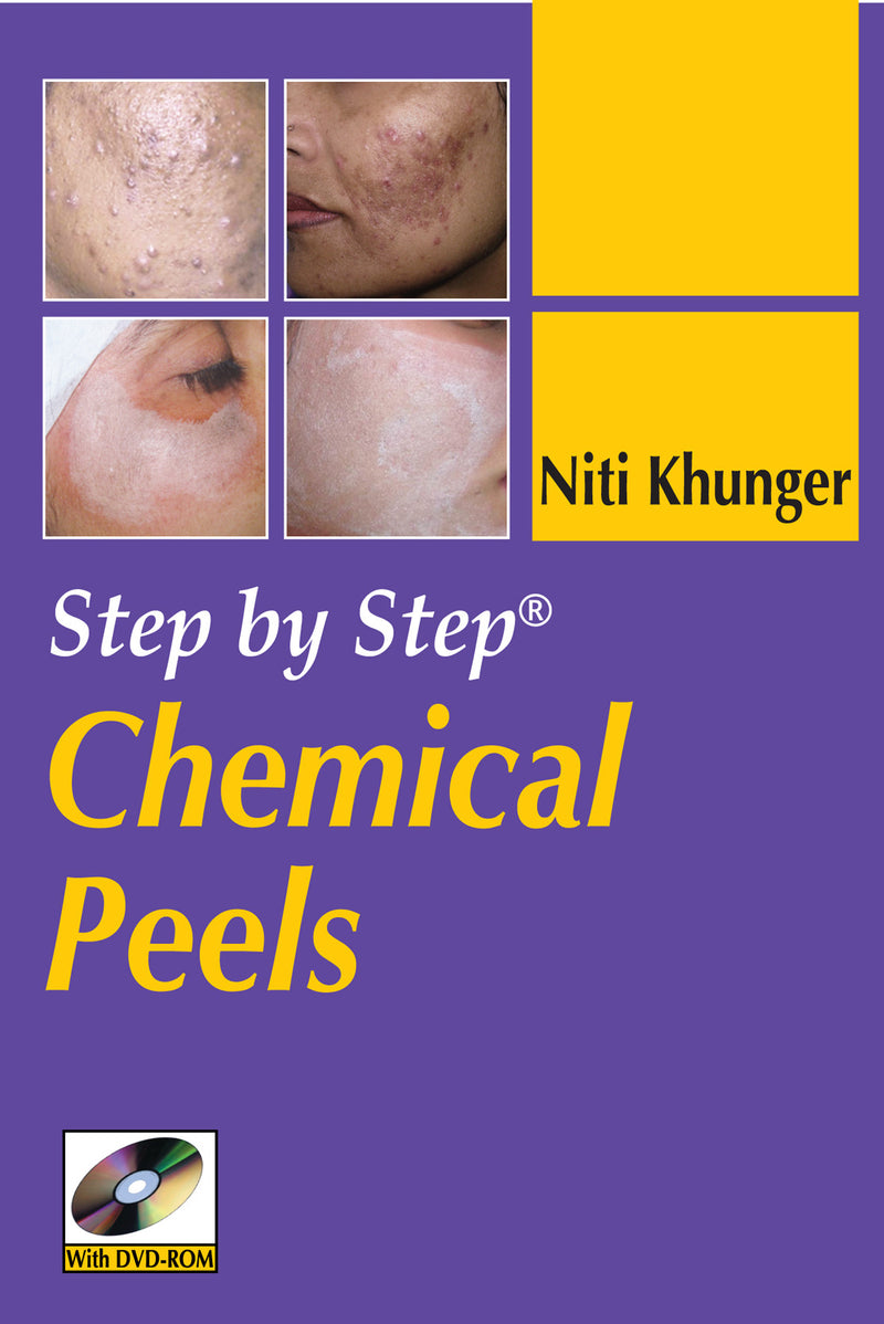 Step By Step Chemical Peels