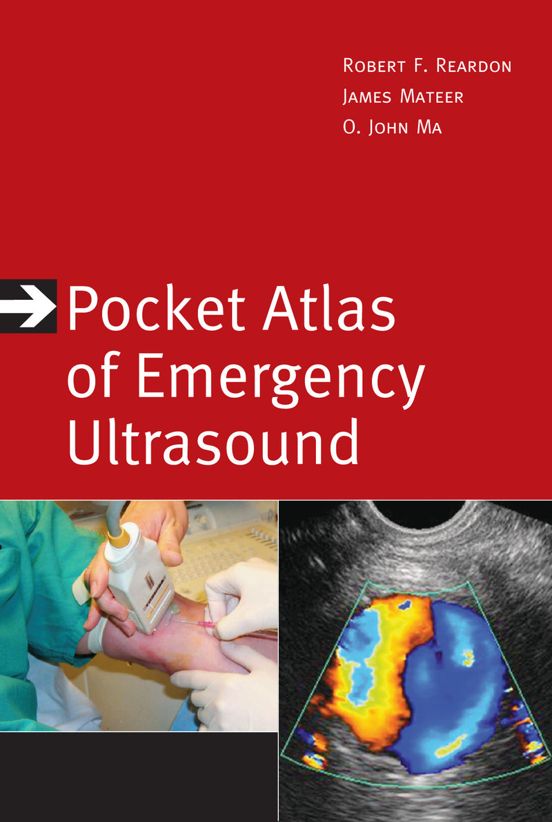 Pocket Atlas Of Emergency Ultrasound