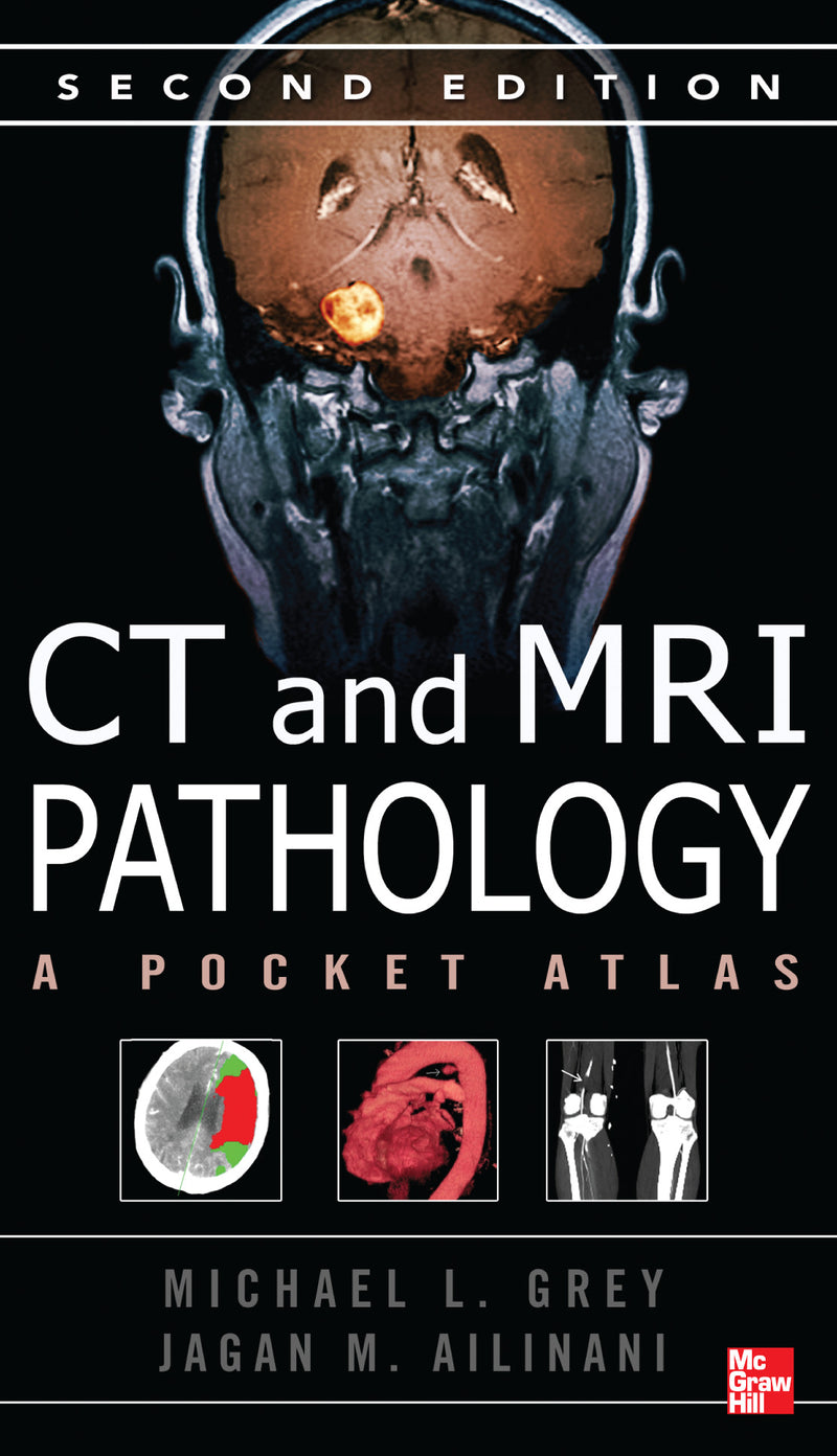 Ct & Mri Pathology A Pocket Atlas Second Edition 2e