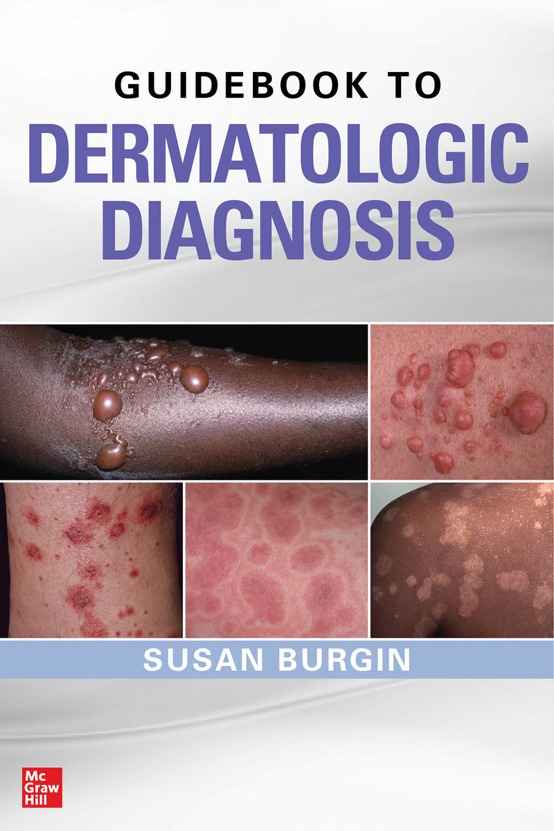 Guidebook To Dermatologic Diagnosis
