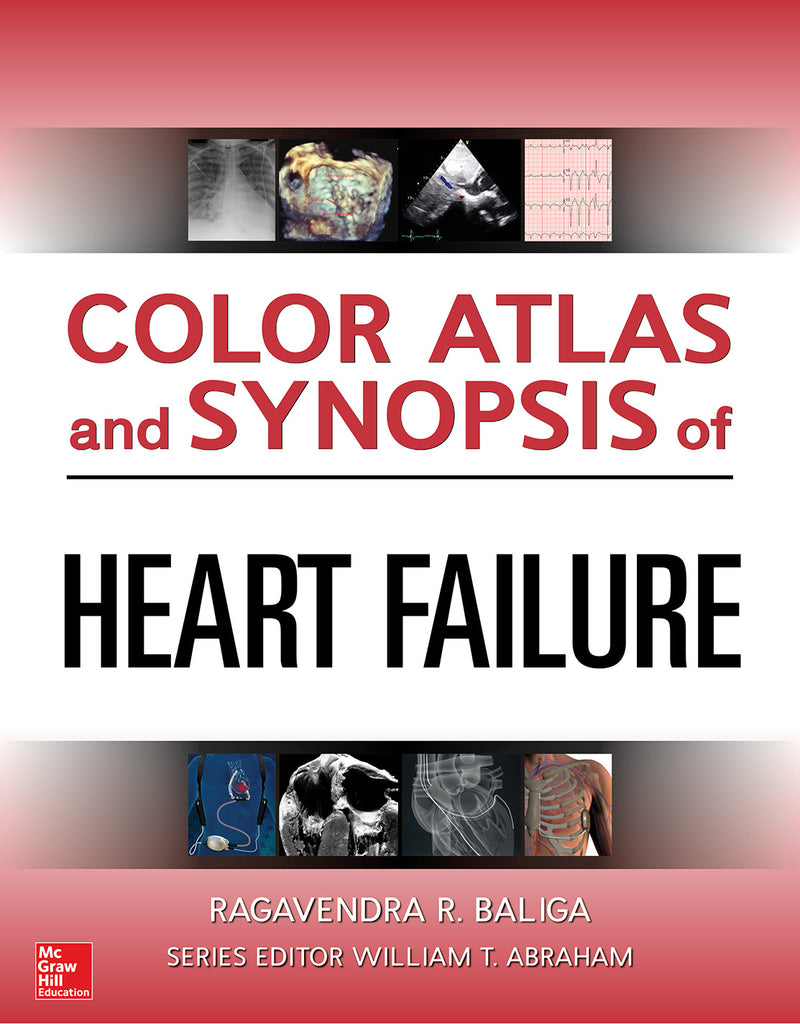 Color Atlas & Synopsis Of Heart Failure