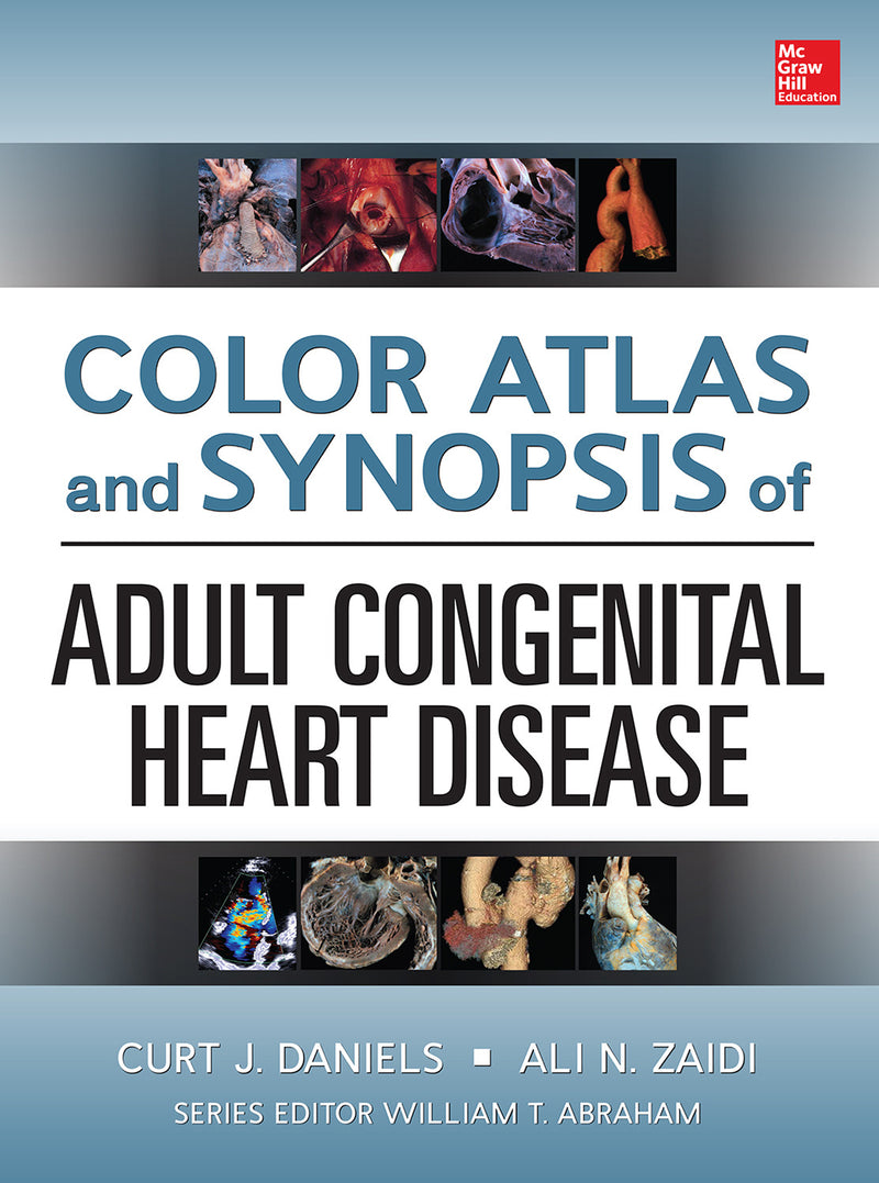 Color Atlas & Synopsis Of Adult Congenital Heart Disease