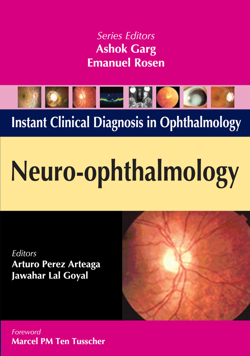 Neuro Ophthalmology
