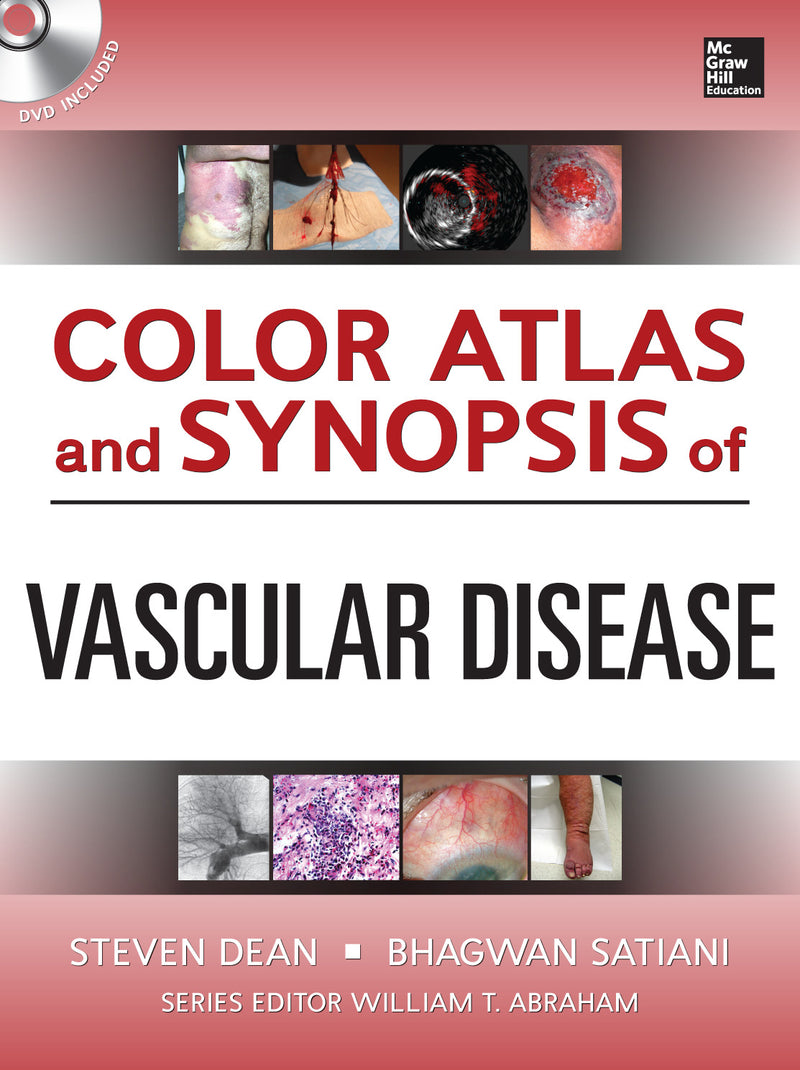 Color Atlas & Synopsis Of Vascular Disease