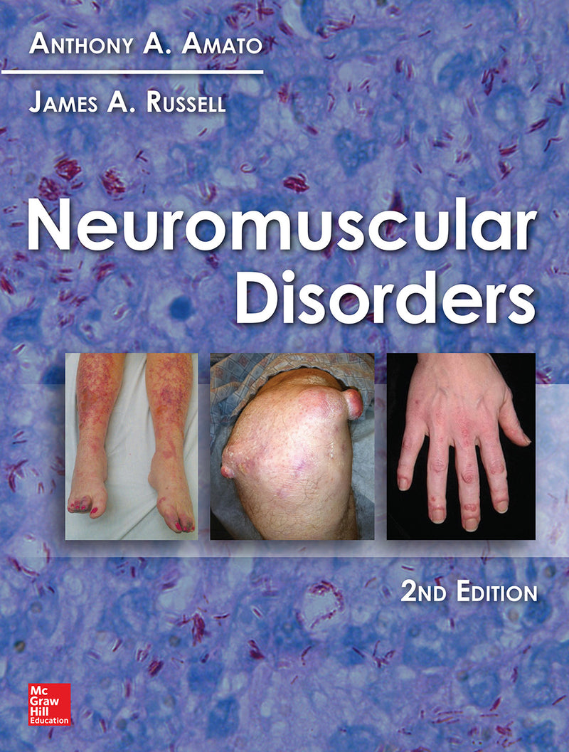 Neuromuscular Disorders 2nd Edition  2e