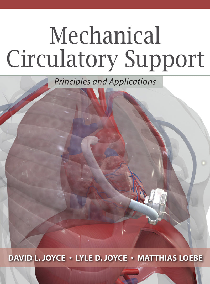 Mechanical Circulatory Support Principles & Applications
