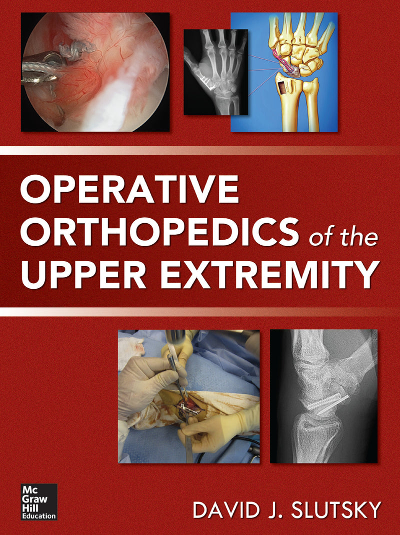 Operative Orthopedics Of The Upper Extremity