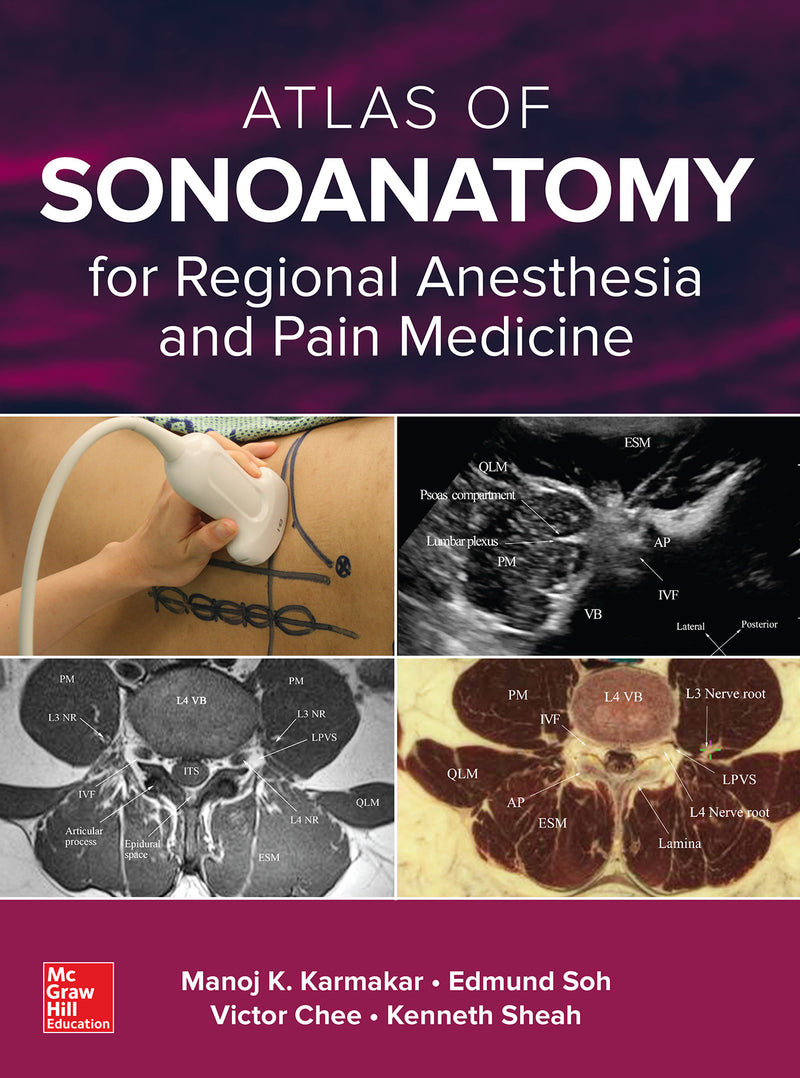 Atlas Of Sonoanatomy For Regional Anesthesia & Pain Medicine