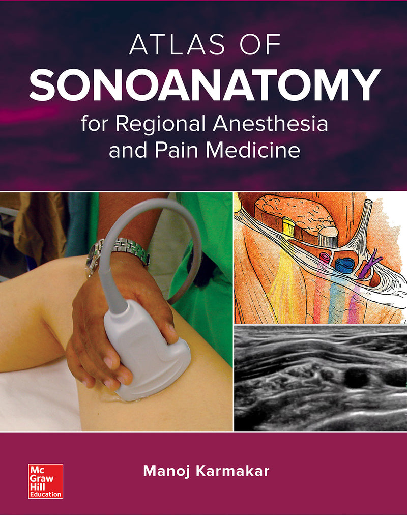 Atlas of Sonoanatomy for Regional Anesthesia and Pain Medicine