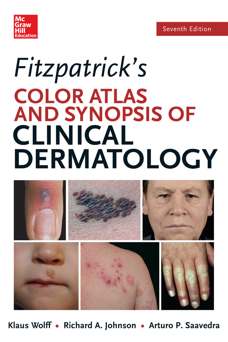 Fitzpatricks Color Atlas & Synopsis Of Clinical Dermatology Seventh Edition 7e