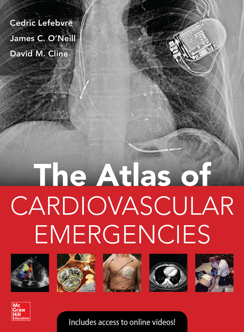 Atlas Of Cardiovascular Emergencies