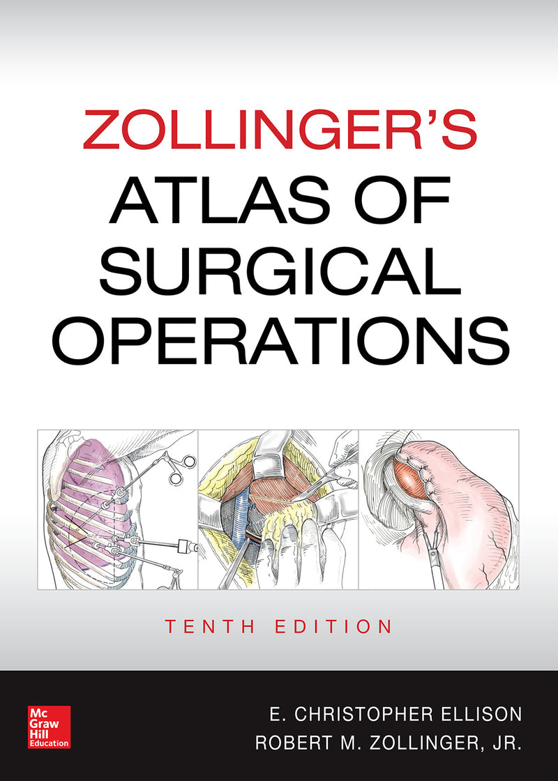 Zollingers Atlas Of Surgical Operations Tenth Edition