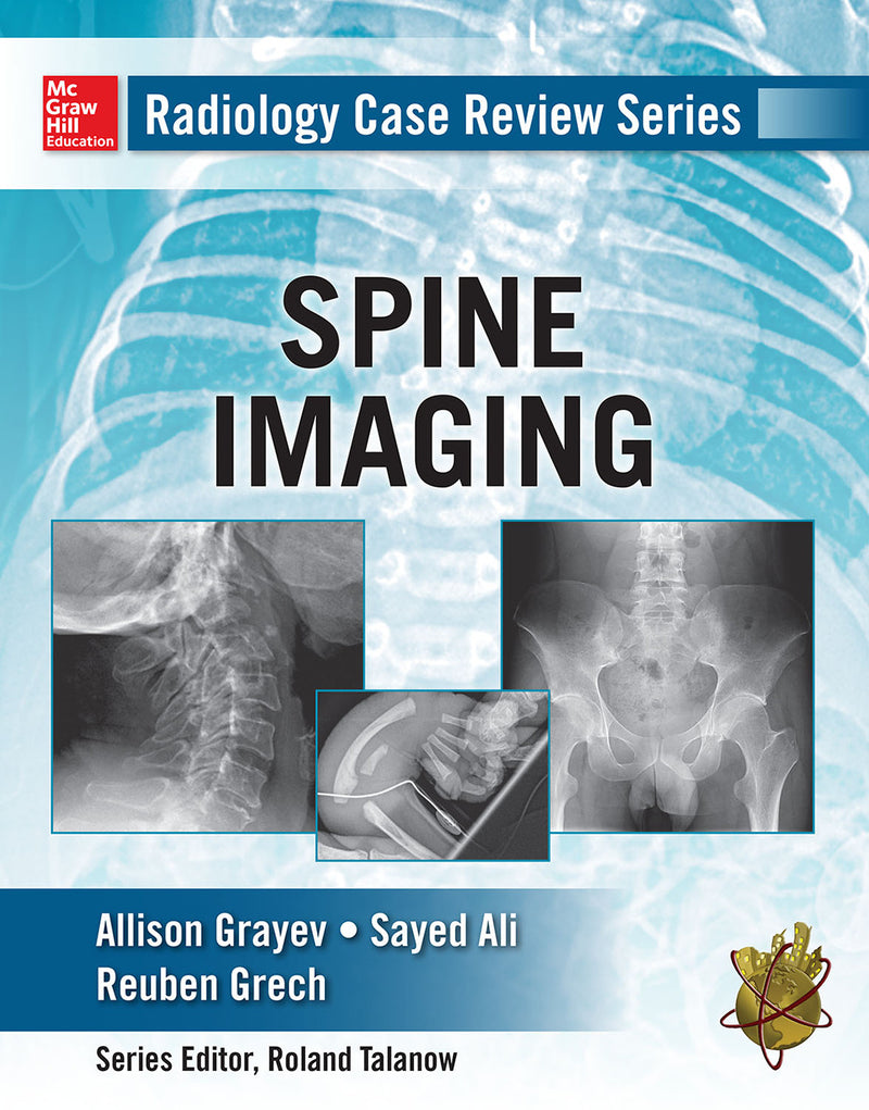 Radiology Case Review Series Spine