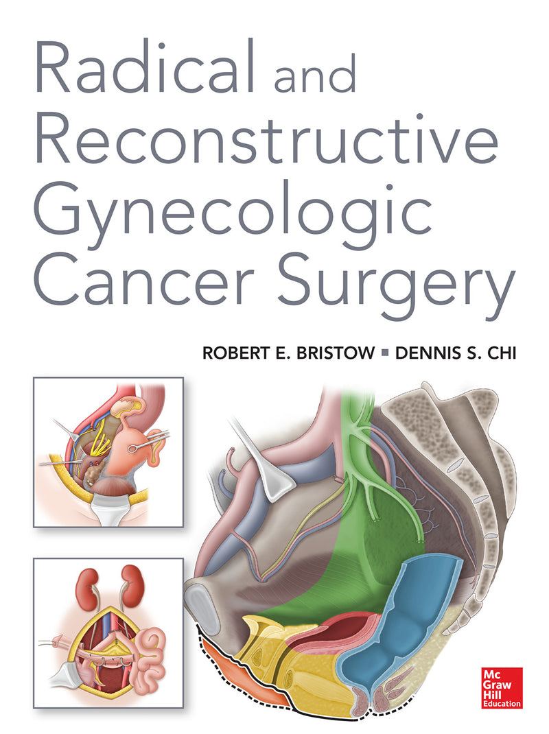 Radical & Reconstructive Gynecologic Cancer Surgery