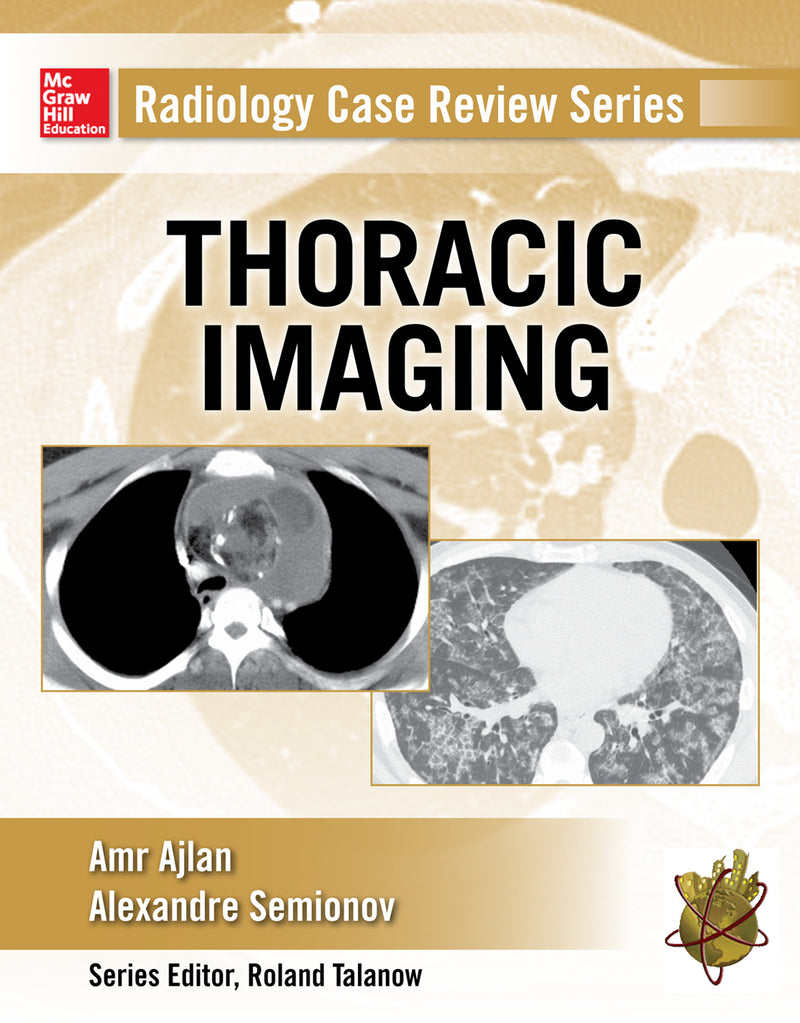 Radiology Case Review Series Thoracic Imaging
