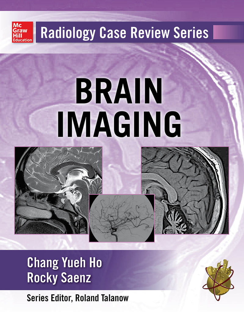 Radiology Case Review Series Brain Imaging