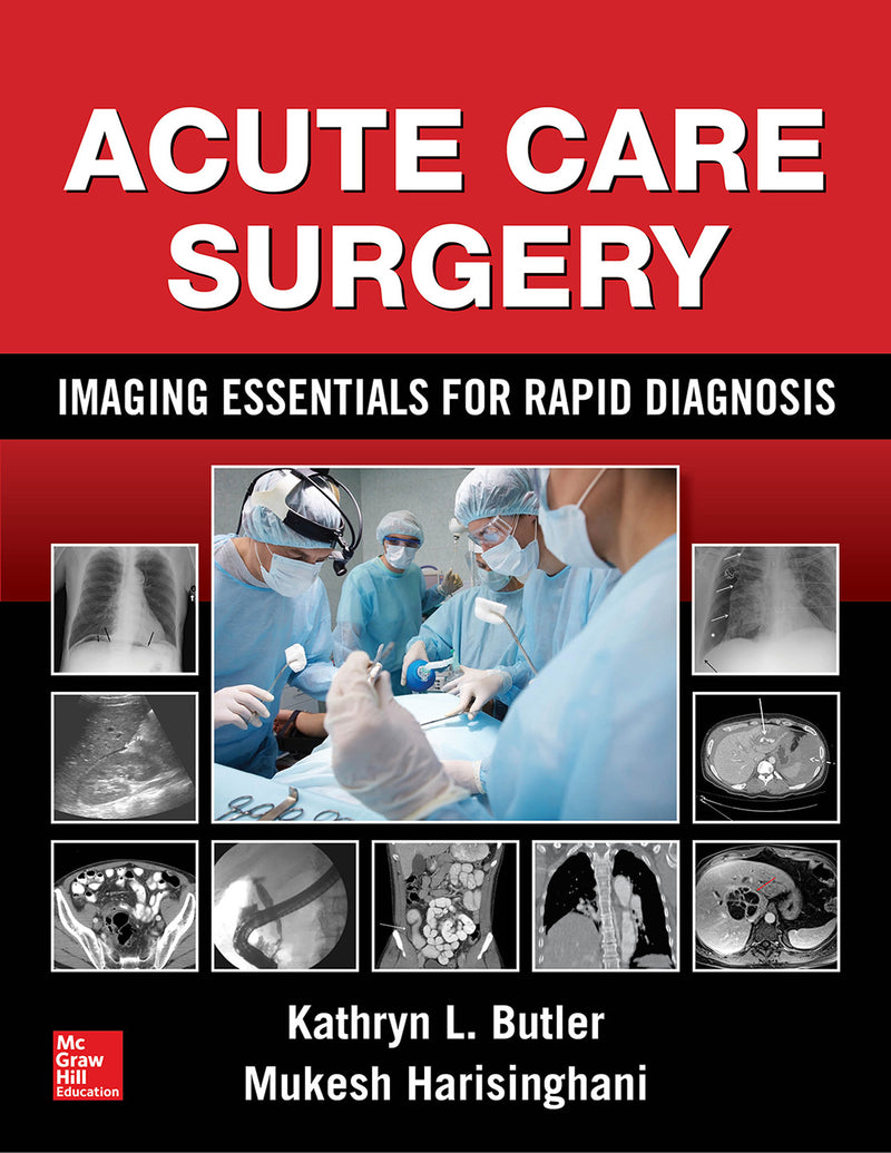 Acute Care Surgery Imaging Essentials For Rapid Diagnosis