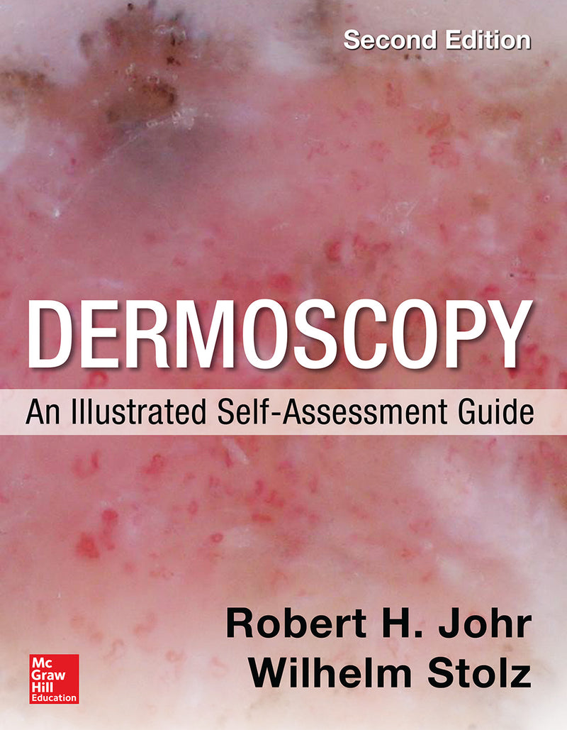 Dermoscopy An Illustrated Self Assessment Guide 2 E 2e