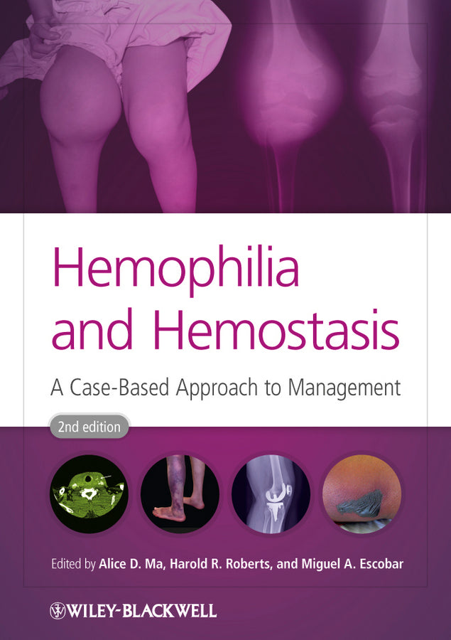 Hemophilia and Hemostasis