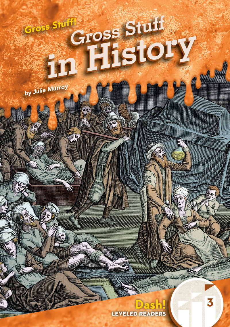 Gross Stuff in History