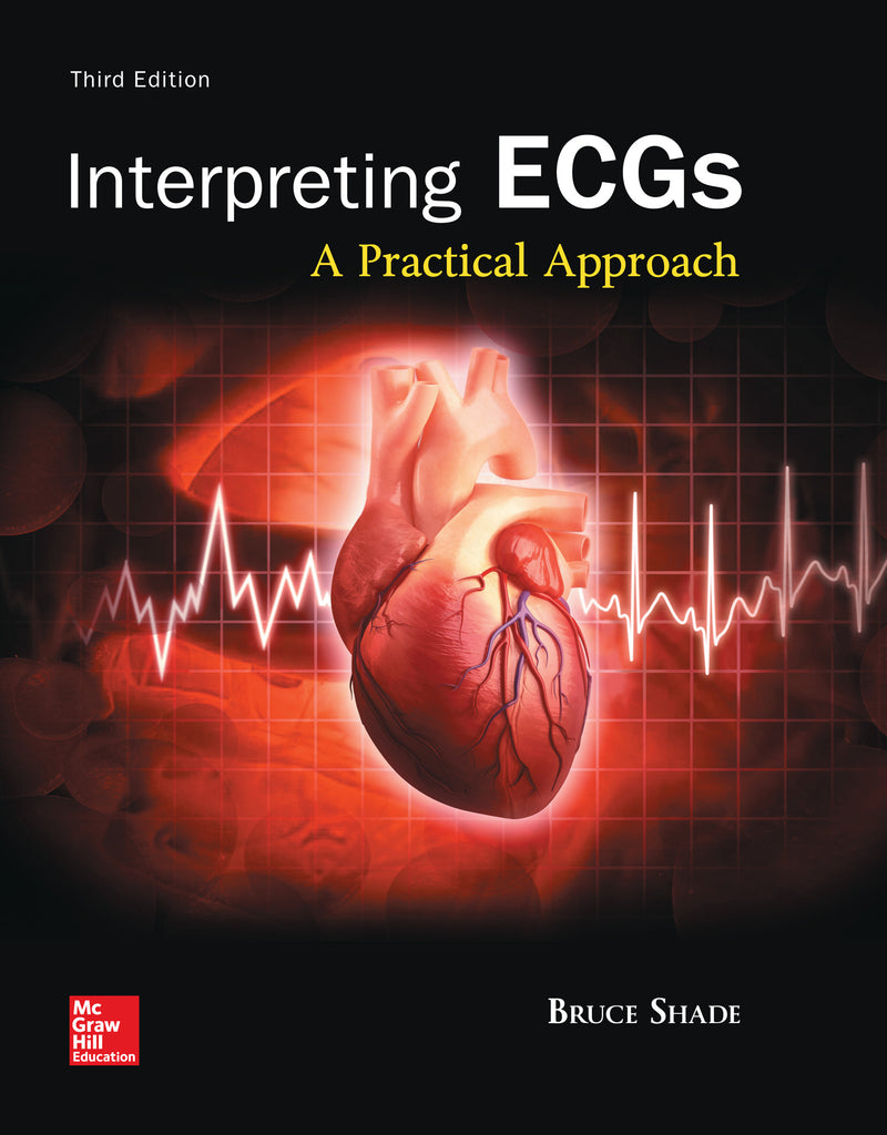 Interpreting Ecgs A Practical Approach 3e