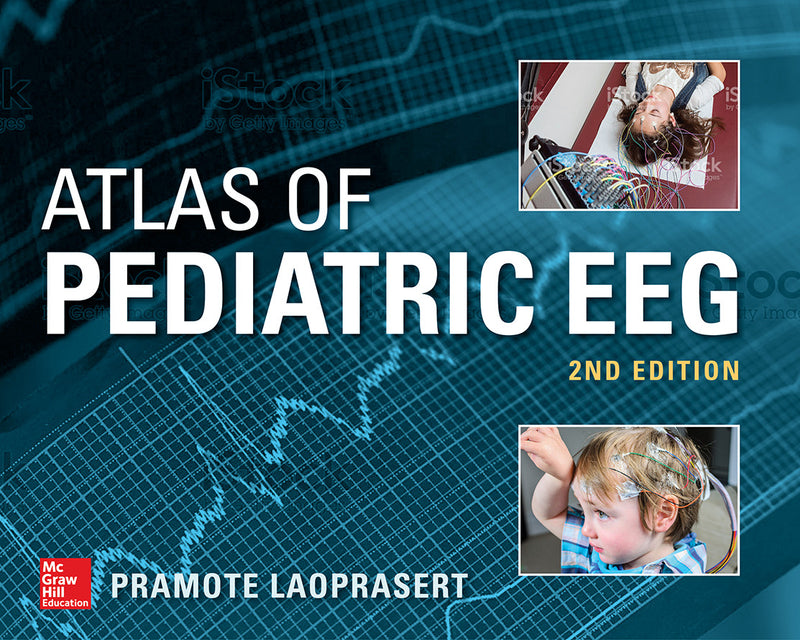 Atlas Of Pediatric Eeg 2nd Edition 2e