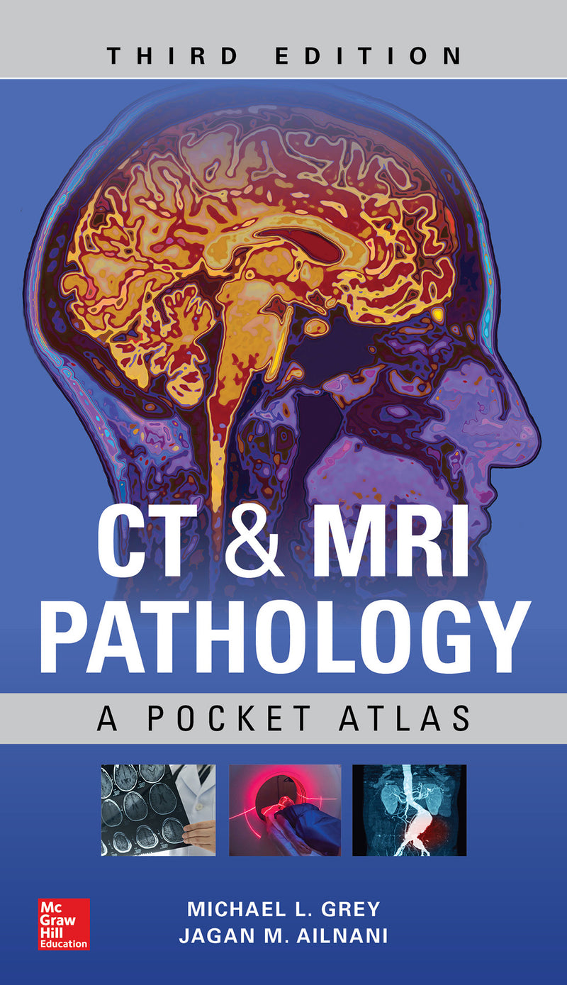 Ct & Mri Pathology A Pocket Atlas Third Edition 3e