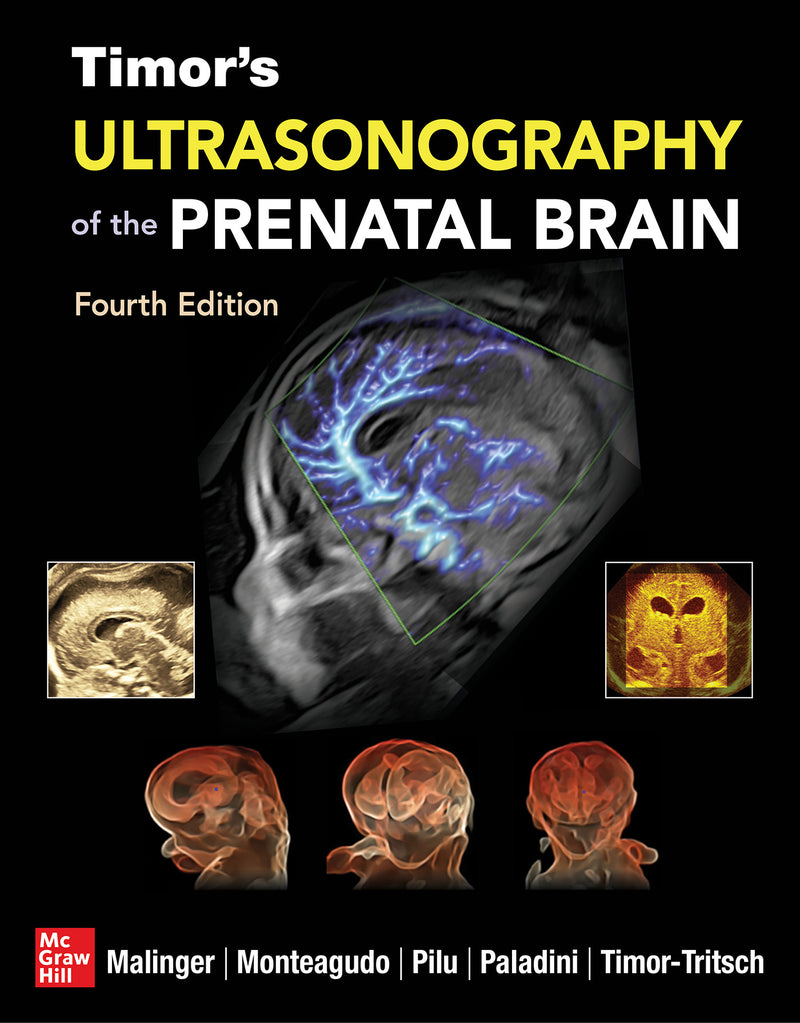 Timors Ultrasonography Of The Prenatal Brain Fourth Edition 4e