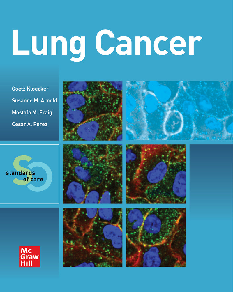 Lung Cancer Standards Of Care